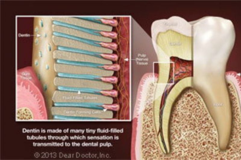 Tooth Sensitivity