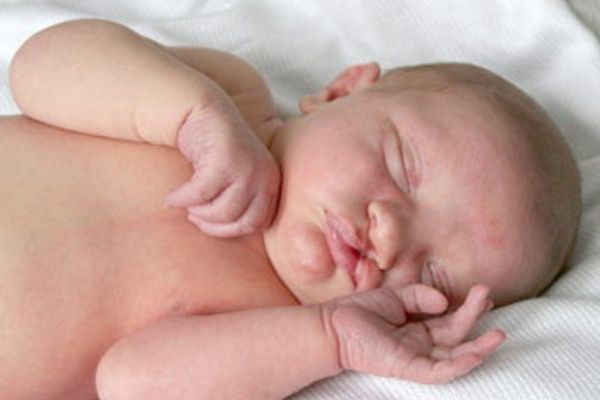 Cleft Lip Palate Repair