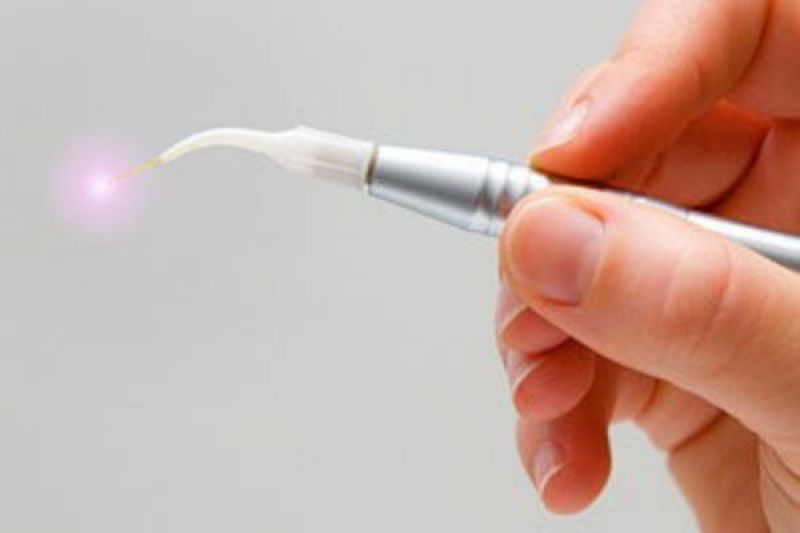 Laser Dentistry