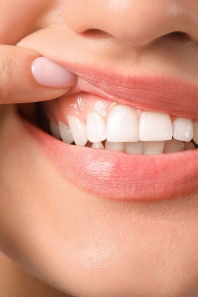 Periodontal Treatment