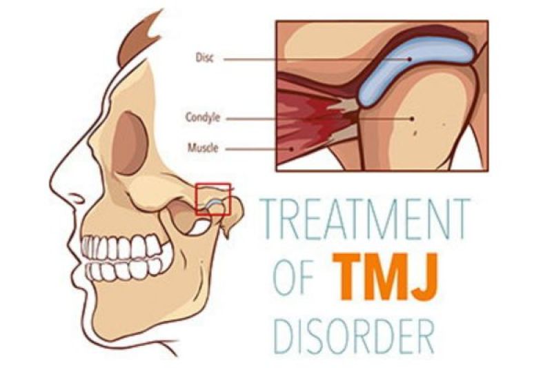 TMD Treatments