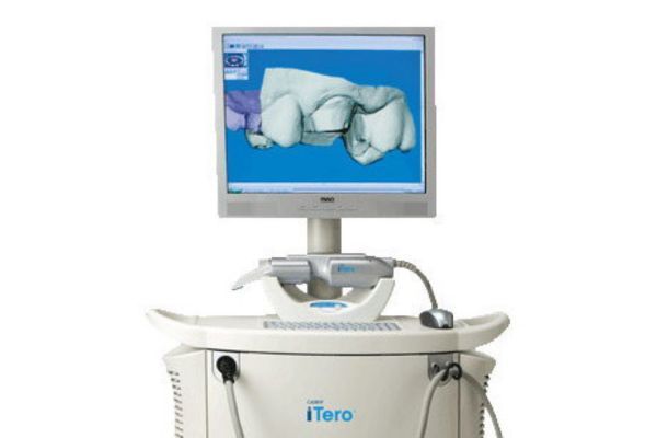 Digital Dental Impressions