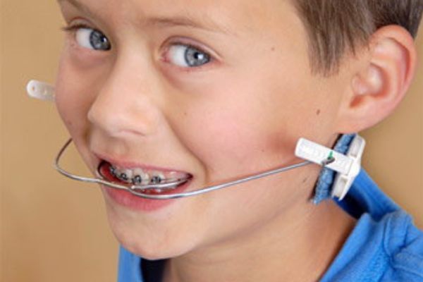 Orthodontic Headgear