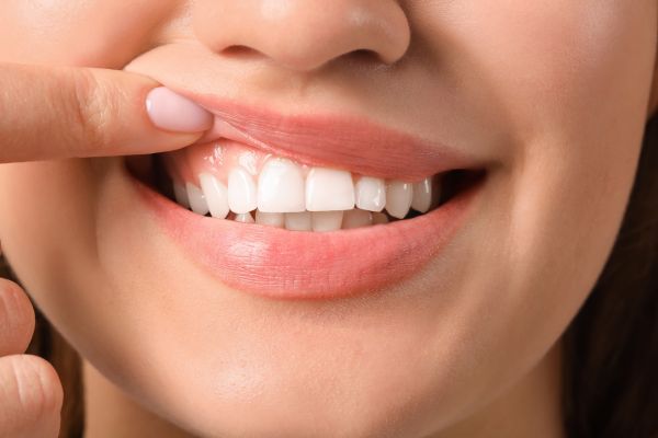 Cosmetic Gum Surgery