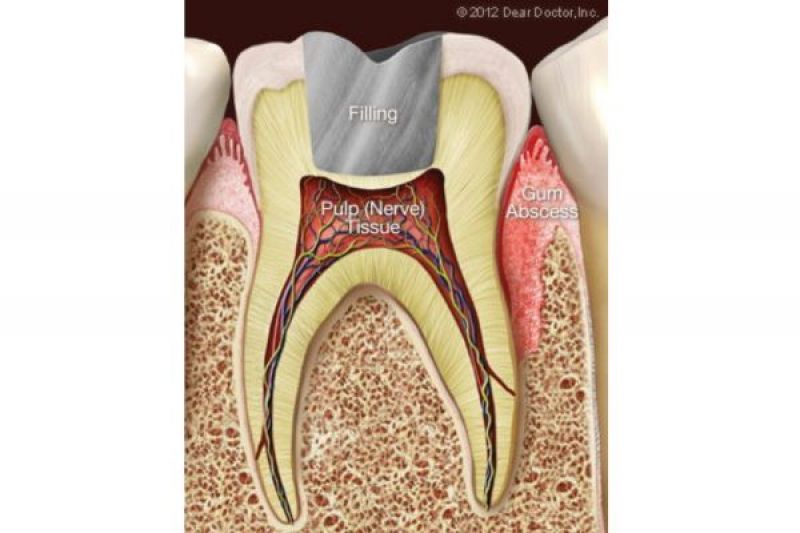Gum Injuries
