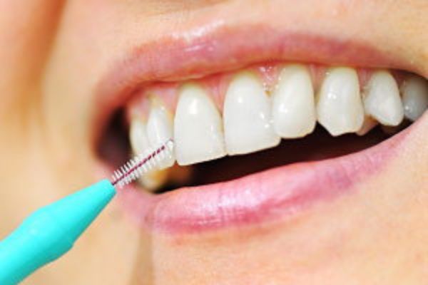 Interdental Cleaning Devices